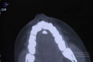 20110906 Photo 1097 1V0yi2gMzZ3huQ1ojQgr8Sw nz1sB9Cz9.JPG